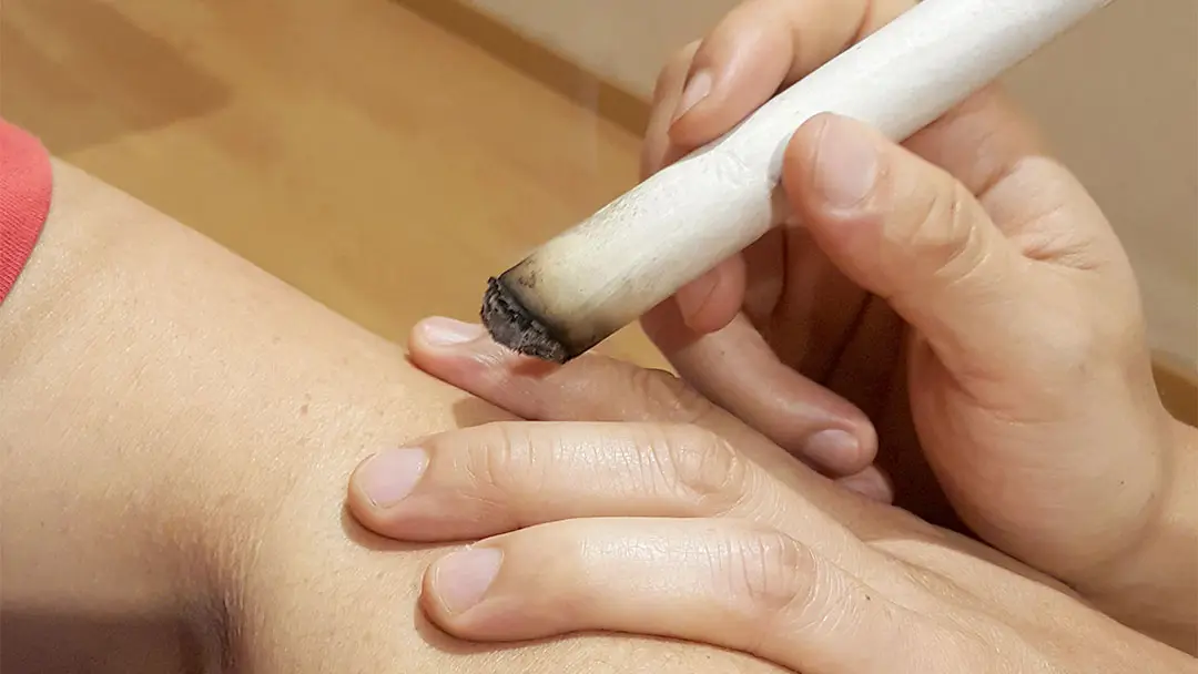 Sesión de moxibustión en Centro Shizendo